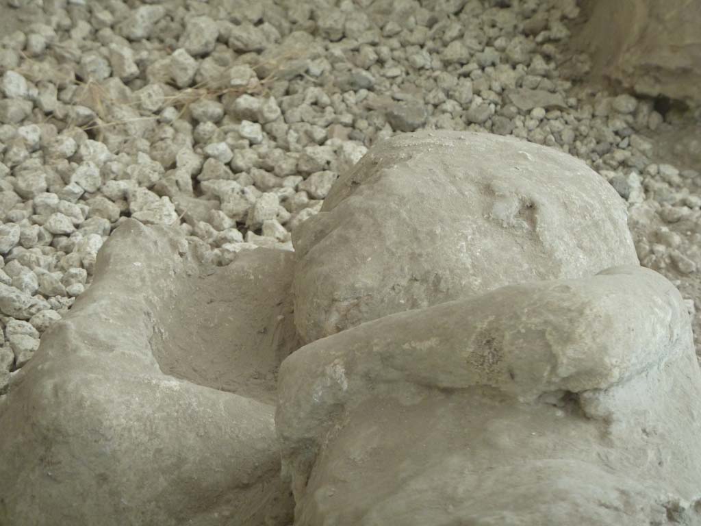 I.21.6 Pompeii. May 2010. Detail of plaster impression of a head of a child, victim 37.